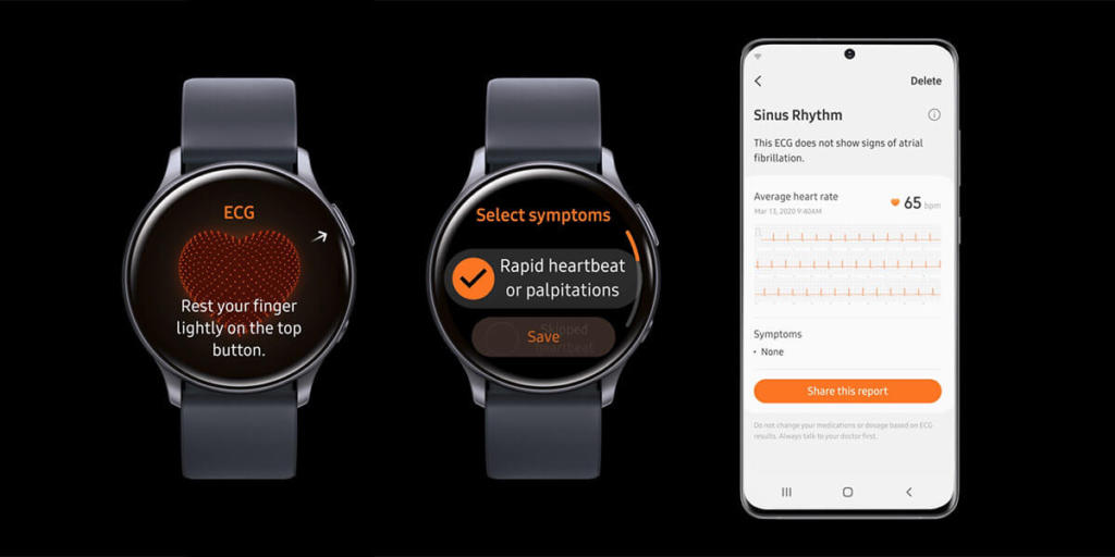 samsung watch ekg