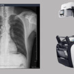AI-based medical tech startup VUNO partnered with Samsung to integrate the VUNO Med-Chest X-ray diagnostic solution with Samsung’s GM85 X-ray system.